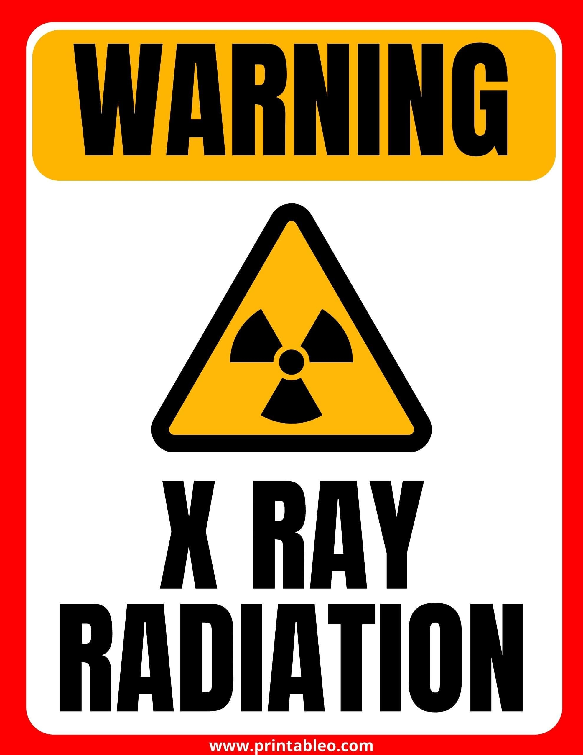 33 Printable X Ray Sign FREE PDF Printableo Com